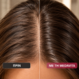 Medavita Lotion Concentree Anti Hair Loss Kit (Lotion Concentree 100ml & ΔΩΡΟ Elisier Hair Serum 50ml) Θεραπεία Τριχόπτωσης